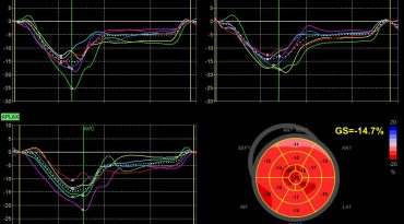 quant2