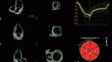 quant4